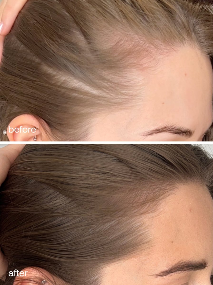Advanced Hair Supplements